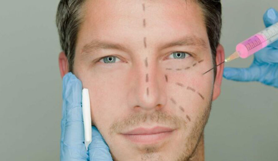 a man marked up for facial surgery