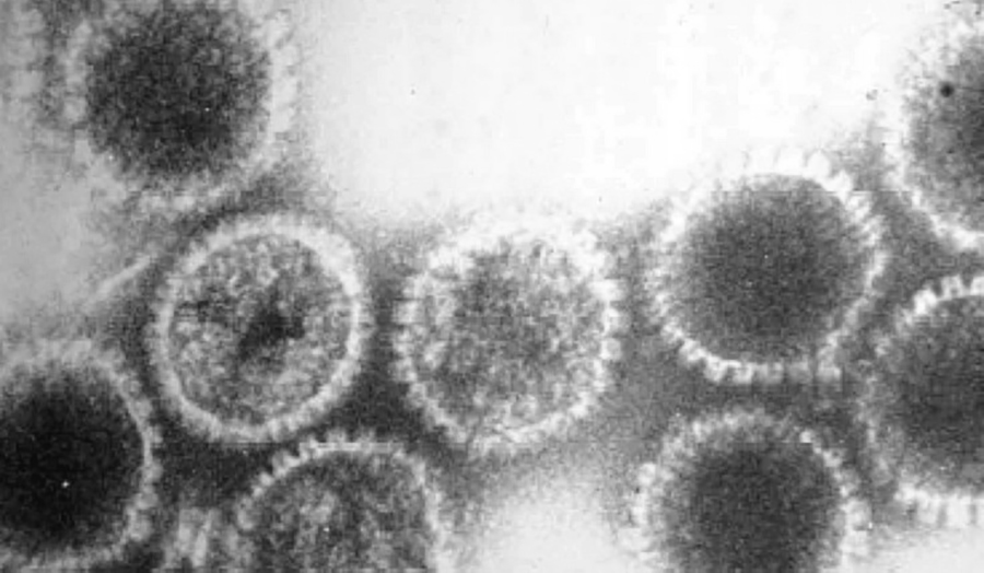 Herpes virus